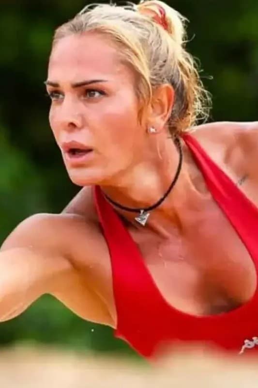 Nagihan Karadere comparte foto de su rostro hinchado: «¡Me afectó el mal de ojo