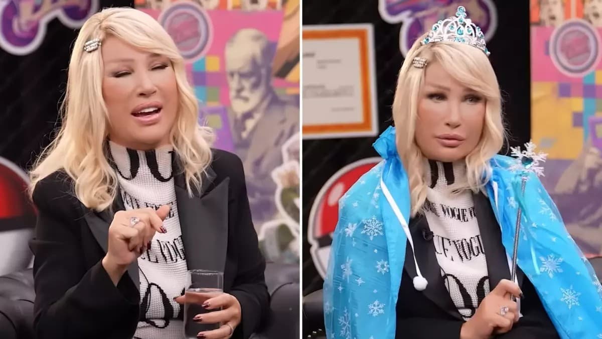 Why Seda Sayan’s Face Appeared Swollen | The Real Reason Behind the Viral Images